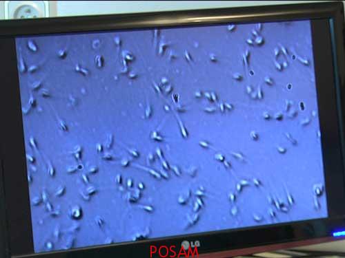 Spermatozoides Grossissement x400 (ICSI)
