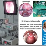 Coeliocopie et Hysteroscopie